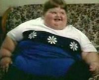 Самый толстый ребенок планеты похудел на 140 килограммов