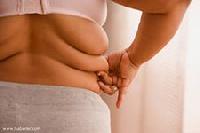 Ожирение провоцирует развитие рака