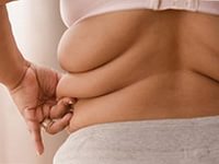 Ожирение у женщин повышает риск развития семи видов рака на 40%